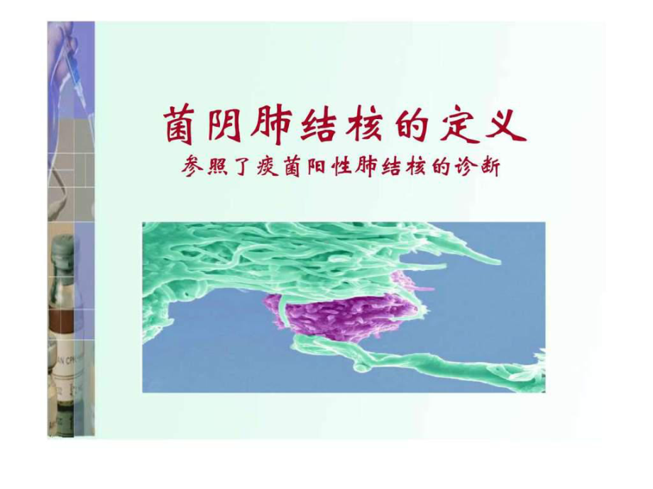 菌阴肺结核的诊断与治疗.ppt37页PPT课件.ppt_第1页