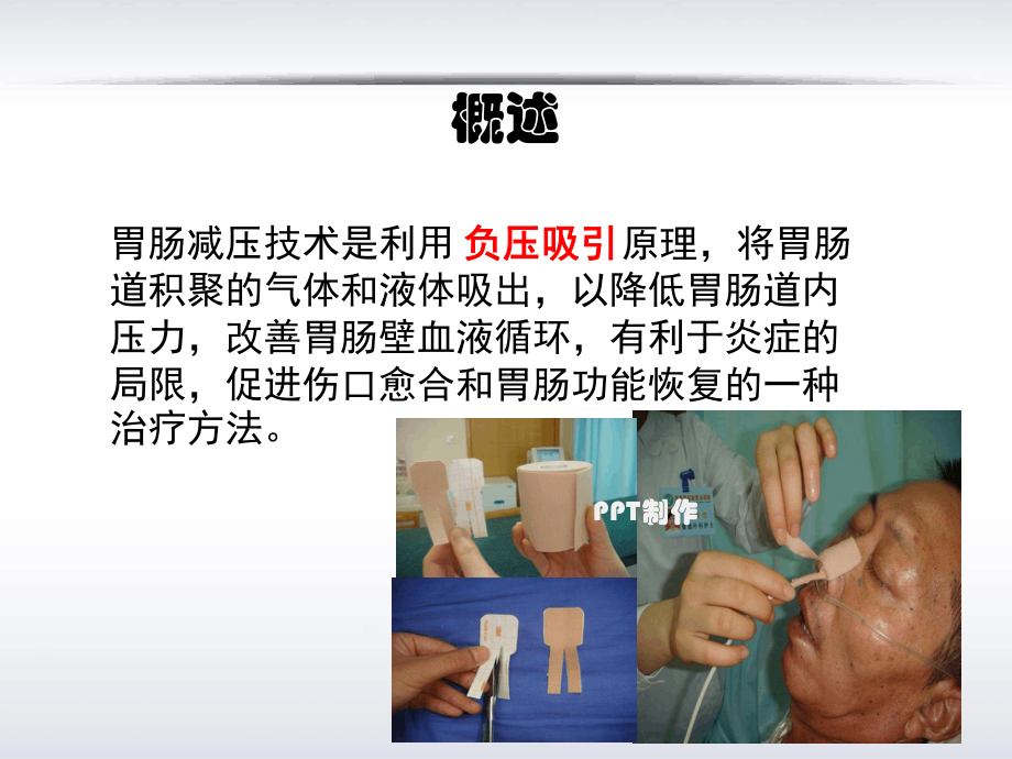 胃肠减压的护理课件.ppt_第3页