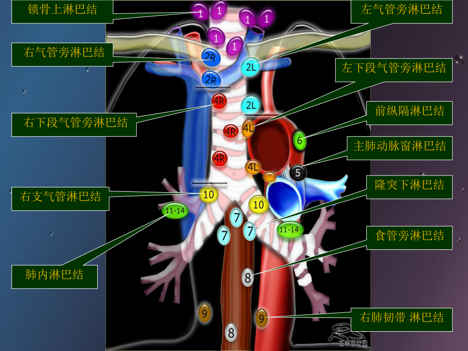 肺癌纵膈肺门淋巴结分区及CT图像PP课件.ppt_第3页