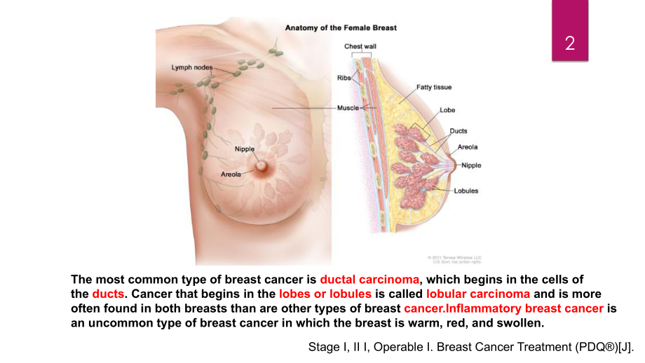 乳腺癌的临床表现与体征课件.pptx_第2页