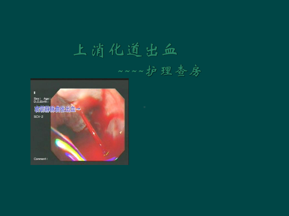 上消化道出血护理查房ppt课件.ppt_第1页