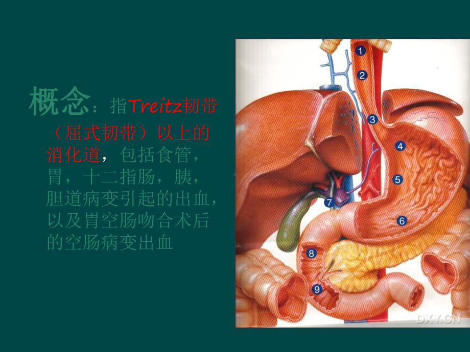 上消化道出血护理查房ppt课件.ppt_第3页