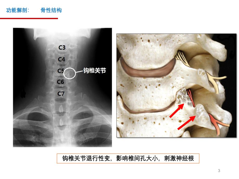 颈椎的功能解剖与颈椎病的鉴别诊断课件.ppt_第3页