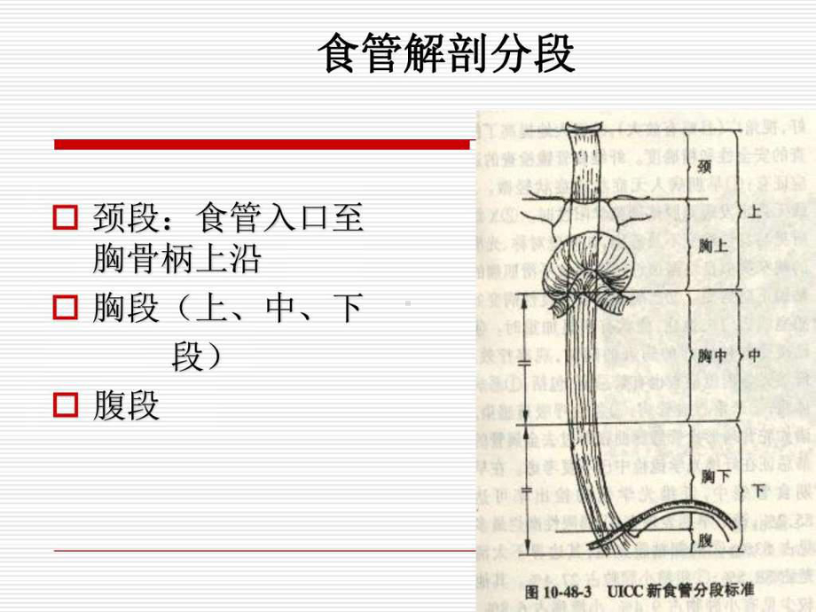 食管癌的围手术期护理ppt课件.ppt_第3页