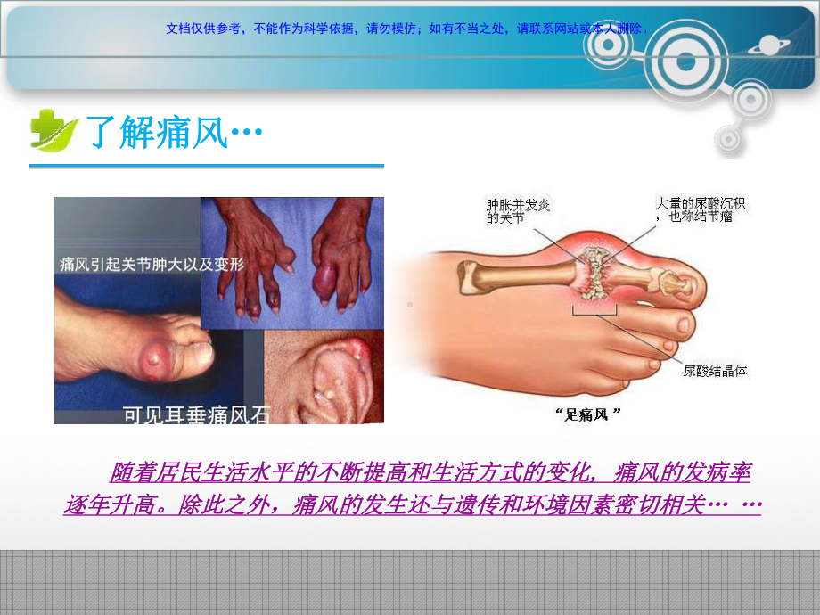 痛风的药物治疗课件.ppt_第1页