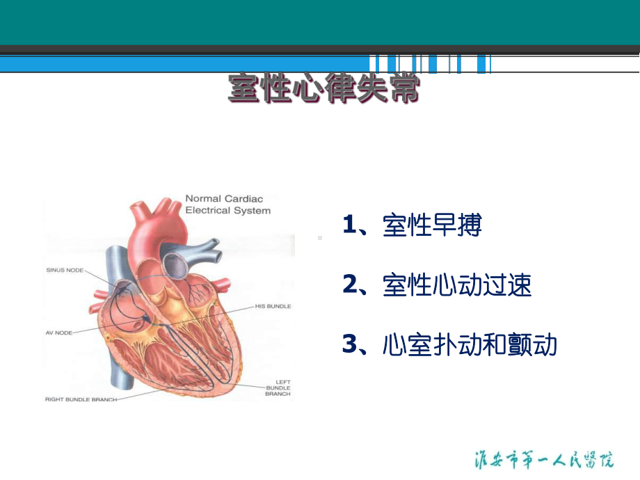 室性心律失常的药物治疗进展-ppt课件.ppt_第2页