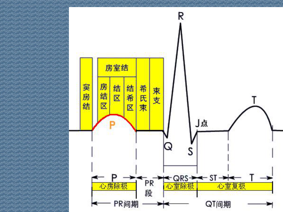 心房、心室肥大心电图表现和诊断课件.ppt_第2页