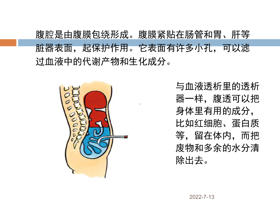 腹膜透析的护理课件.ppt_第3页