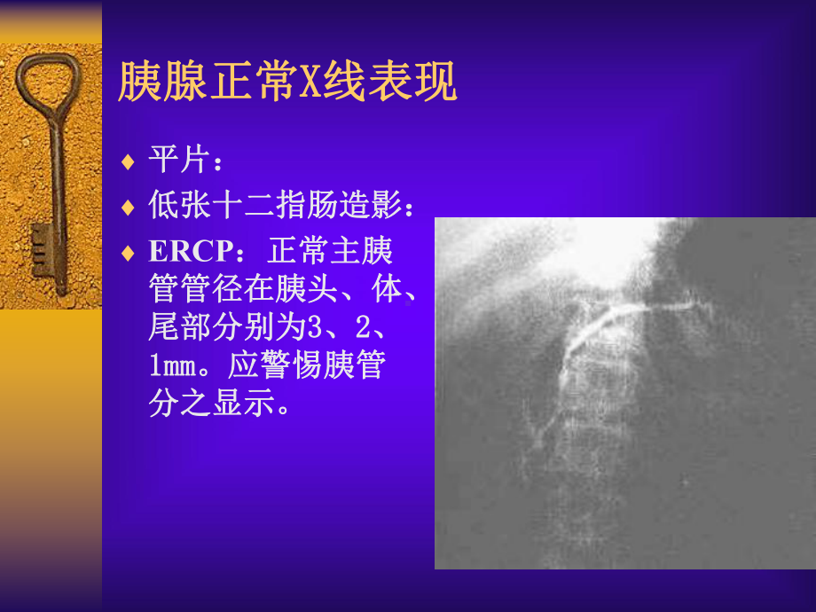 CT胰腺影像学表现课件.ppt_第2页