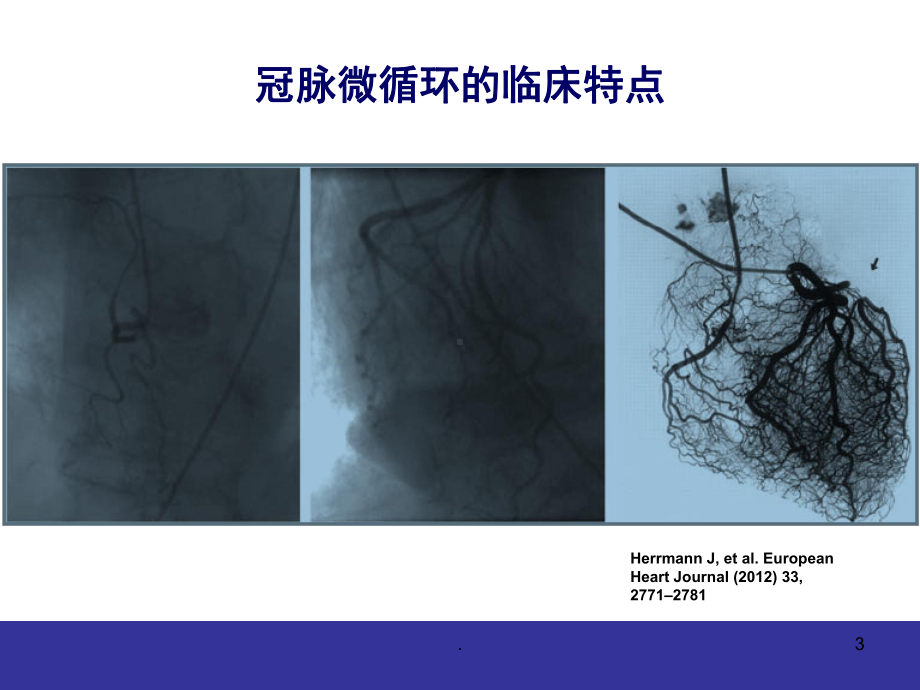 (医学课件)冠脉微血管病变的临床特点与防治ppt演示课件.pptx_第3页