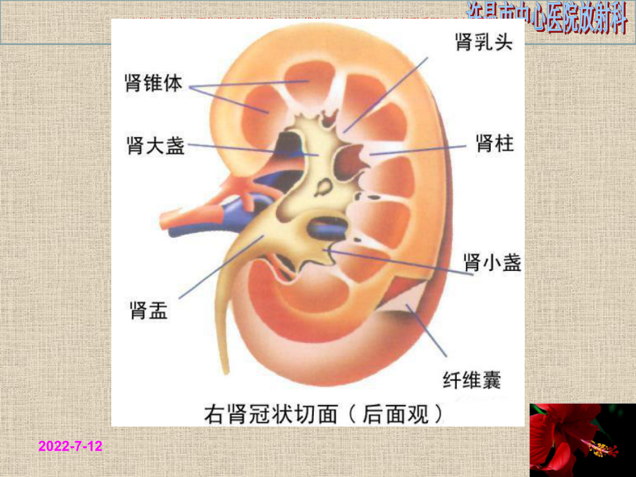 髓质海绵肾的CT表现课件.ppt_第3页