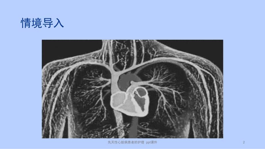 先天性心脏病患者的护理-ppt课件.pptx_第2页