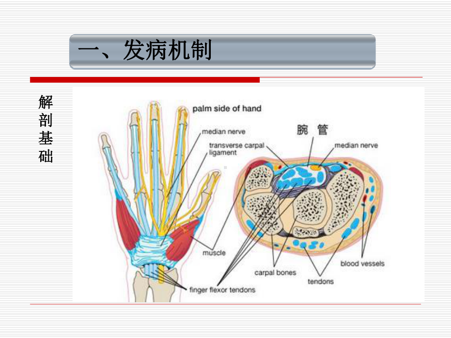 腕管综合征的诊断课件.ppt_第3页