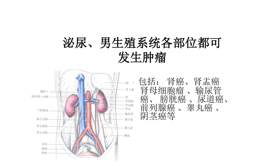 泌尿、男生殖系统肿瘤课件.pptx_第2页