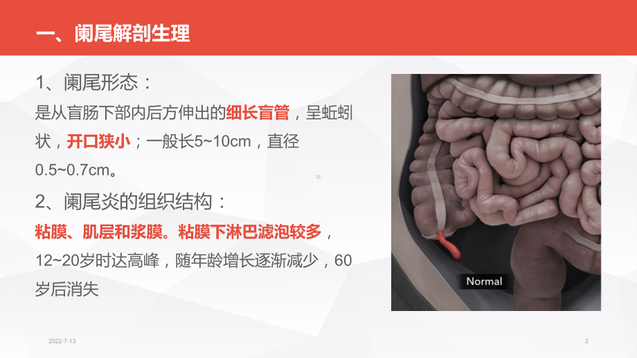 急性阑尾炎病人的护理PPT课件1.ppt_第2页