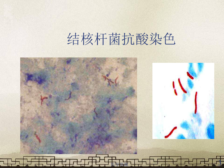 结核杆菌-ppt课件.ppt_第3页