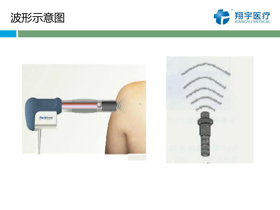 医学国产气动弹道式体外冲击波治疗仪PPT培训课件.ppt_第3页