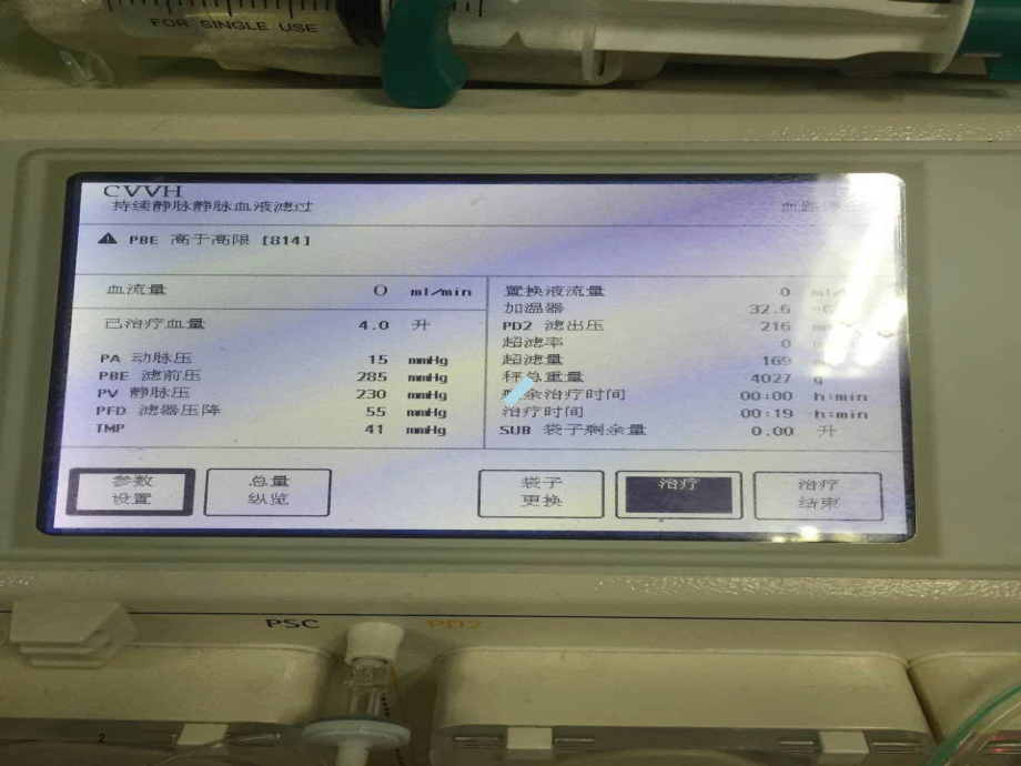 贝朗CRRT治疗常见报警案例分析课件.ppt_第2页