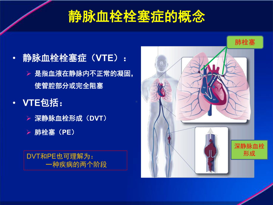 静脉血栓栓塞症(VTE)PPT课件.ppt_第2页