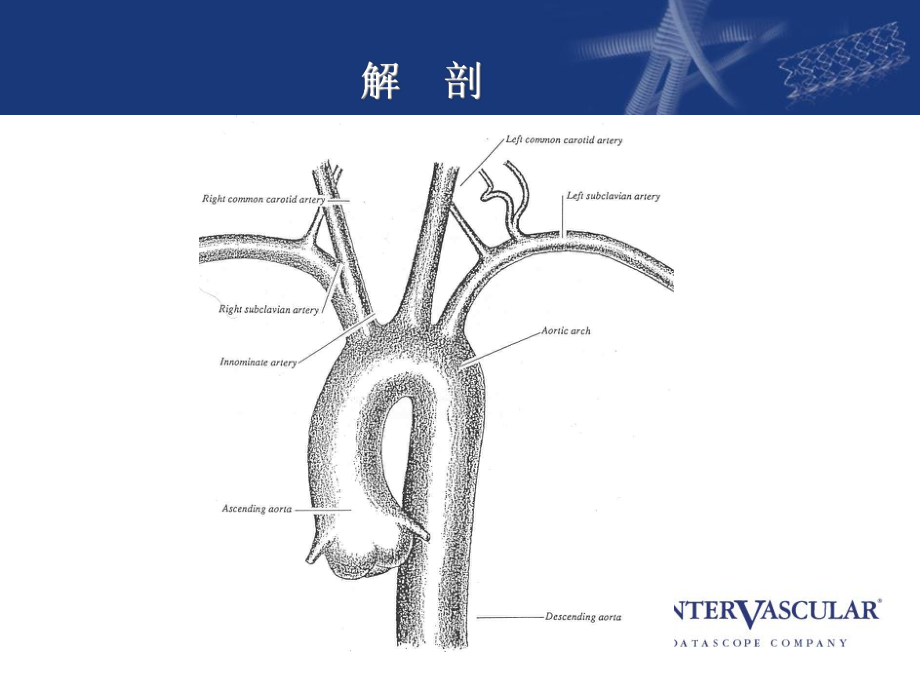 阜外大血管：胸主动脉手术.课件.ppt_第2页