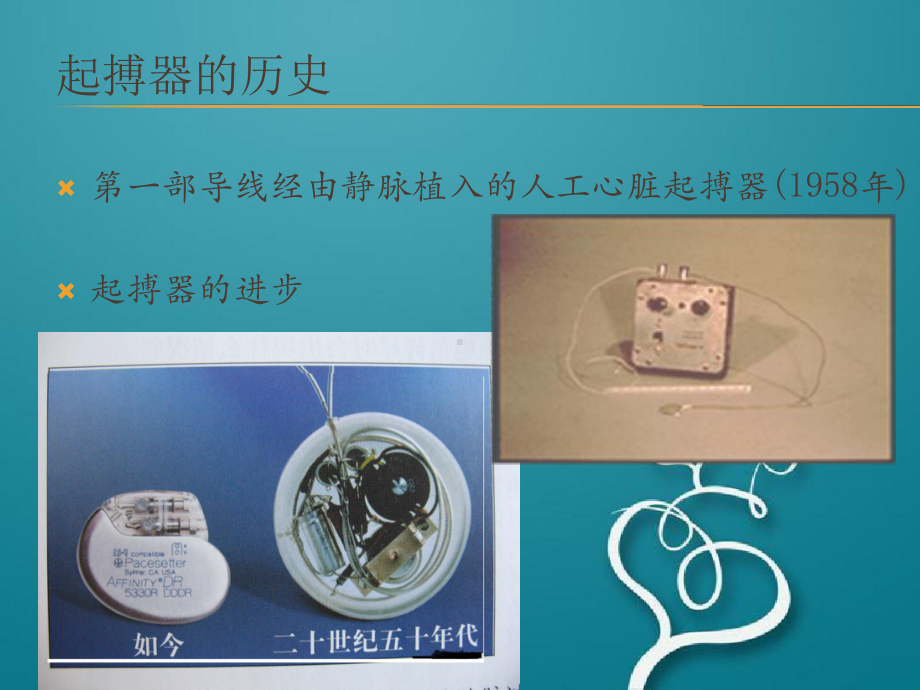 人工心脏起搏器治疗课件.ppt_第3页