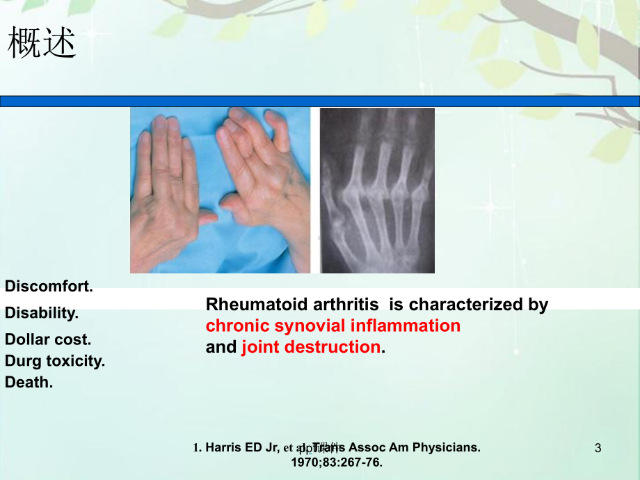 类风湿性关节炎的诊断及治疗-ppt课件.ppt_第3页