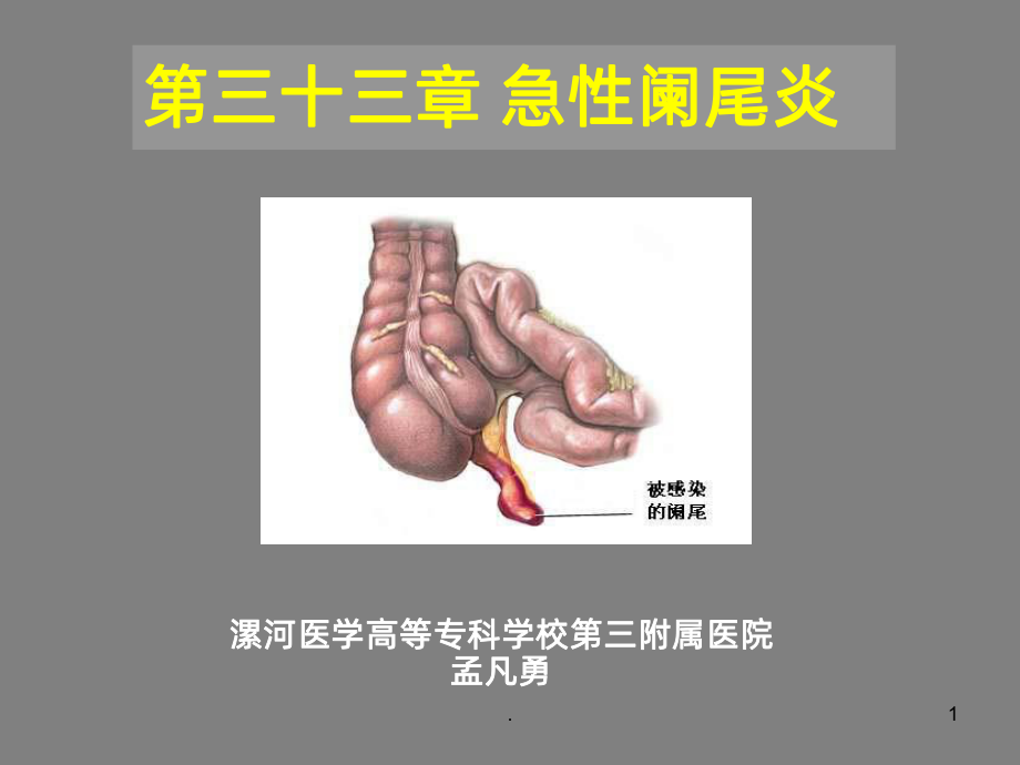 急性阑尾炎课件PPT课件.ppt_第1页