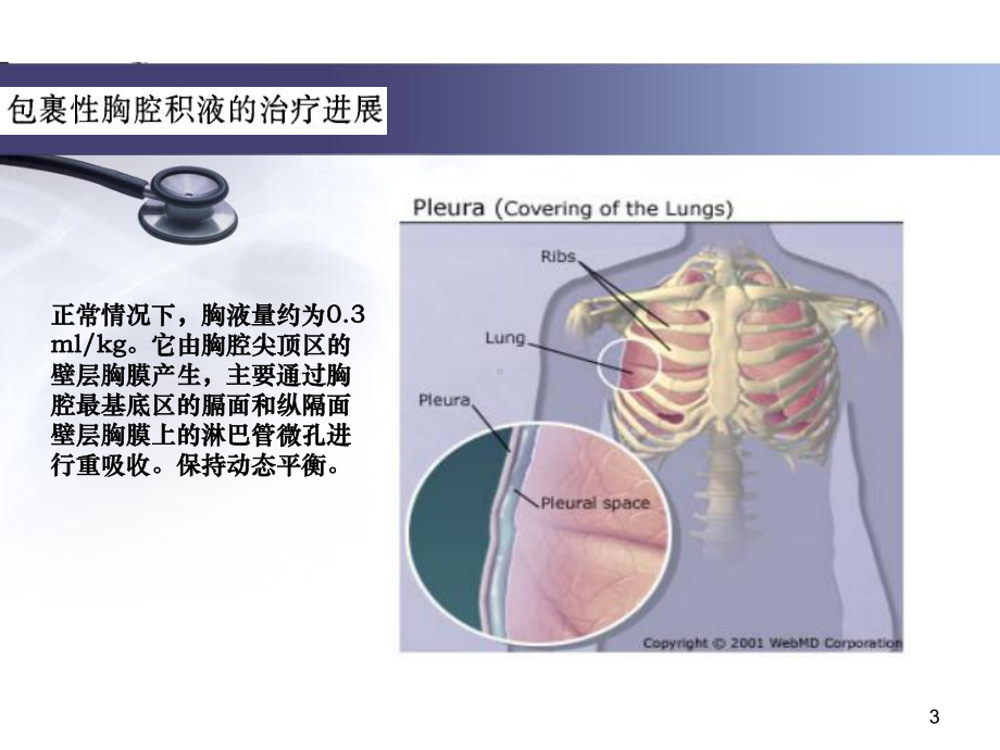 包裹性胸腔积液的治疗进展PPT课件.ppt_第3页