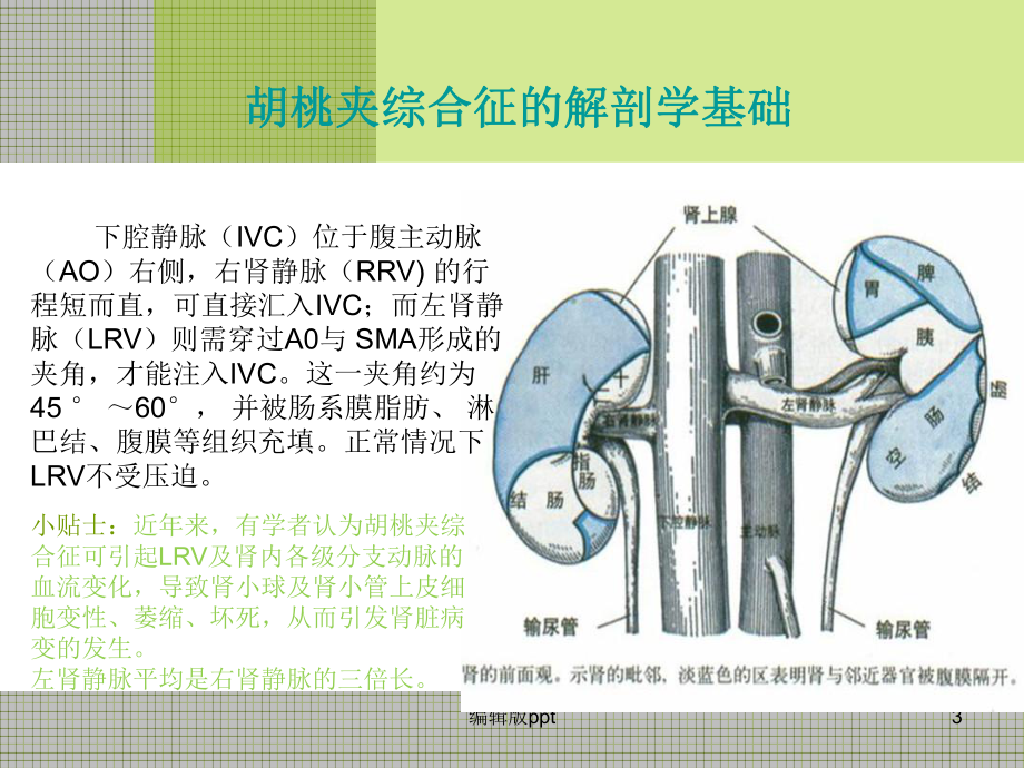 胡桃夹综合征最新PPT课件.ppt_第3页