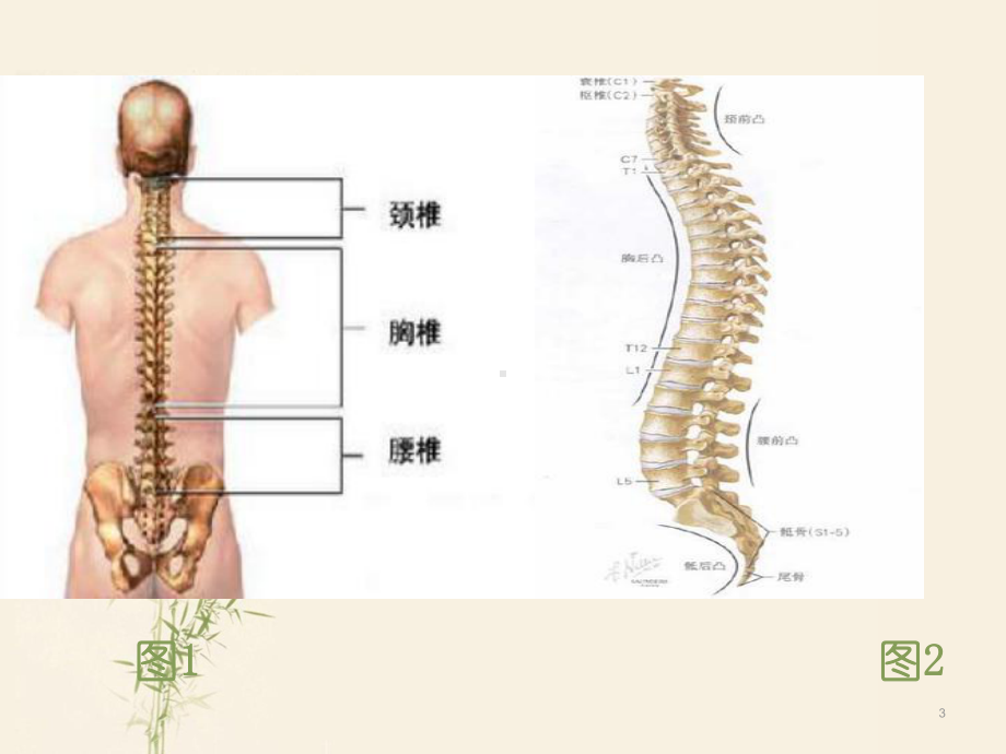 脊柱侧弯诊断及治疗PPT课件.ppt_第3页