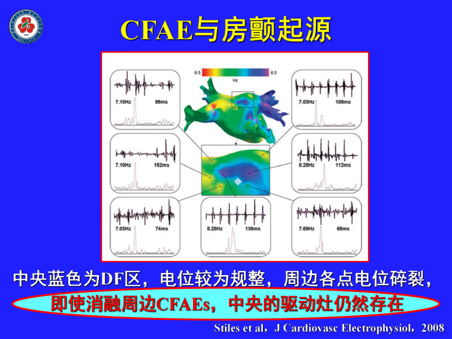 导管消融治疗房颤进展黄从新课件.ppt_第3页