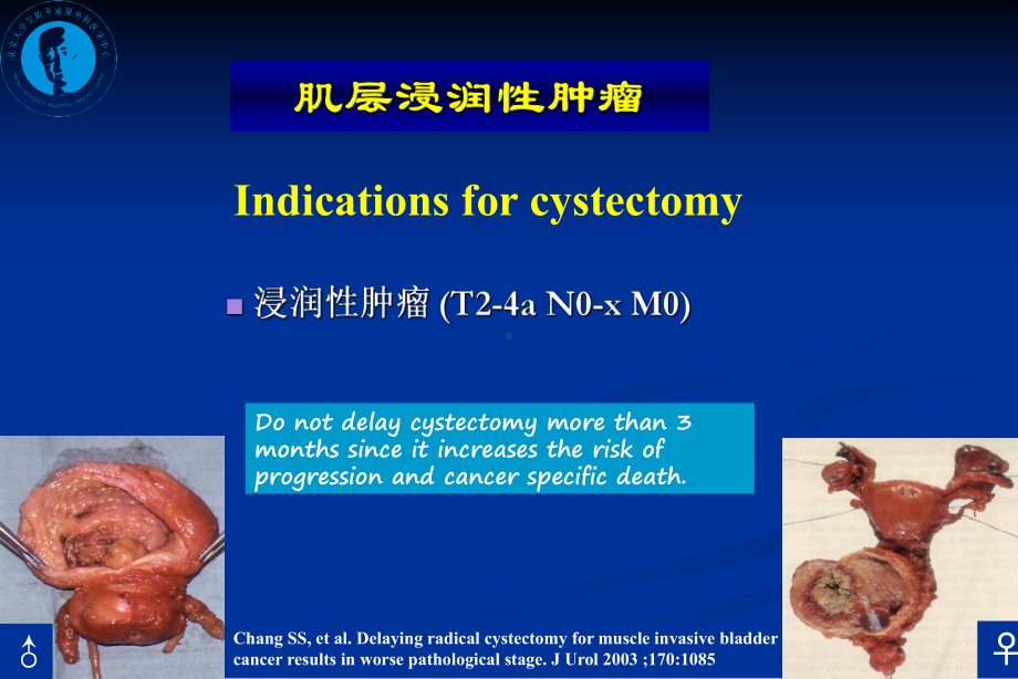 浸润性膀胱癌保留膀胱的治疗课件.ppt_第3页