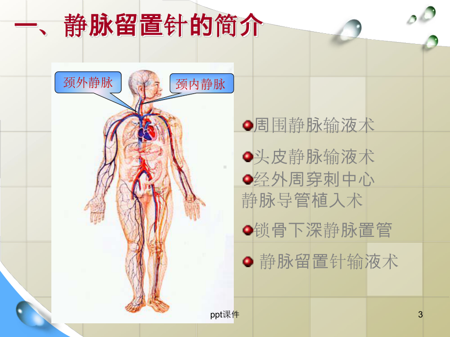 静脉留置针并发症及护理小讲课-ppt课件.ppt_第3页