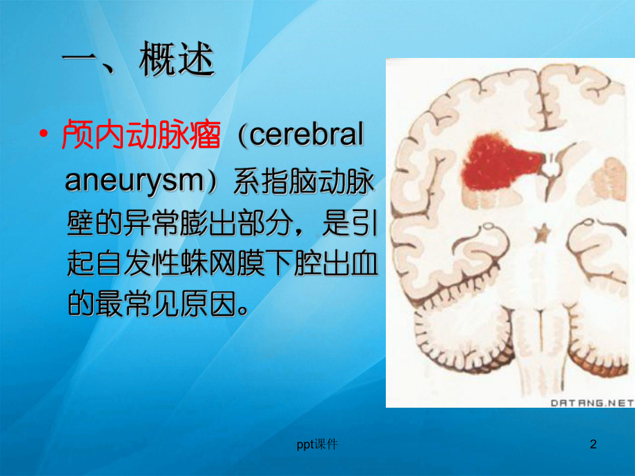 颅内动脉瘤手术前后的护理-ppt课件.ppt_第2页