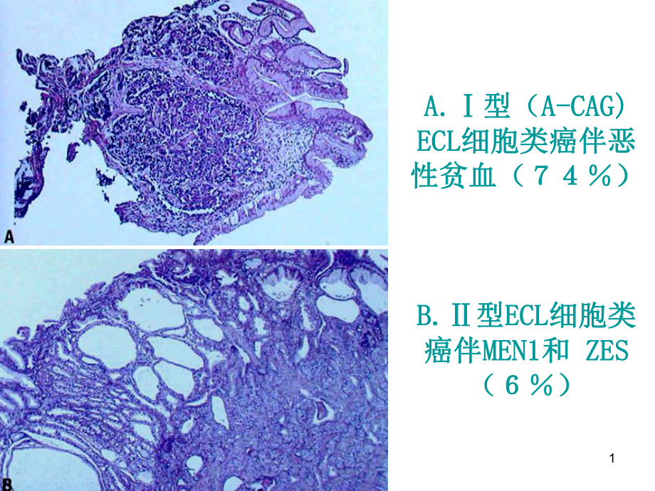 组织病理学-诊断消化-PPT课件.ppt_第1页