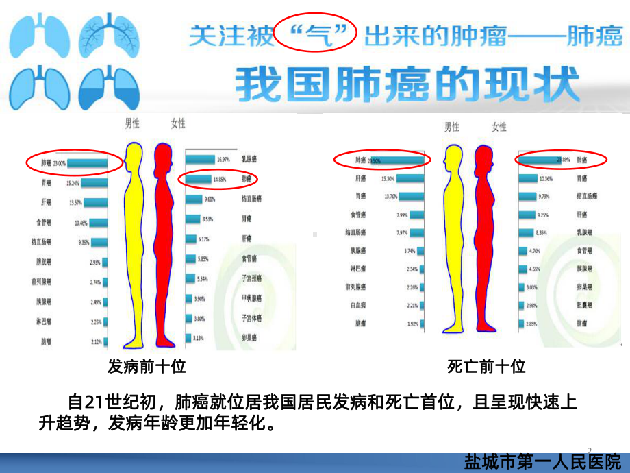 肺癌的围手术期护理PPT课件.ppt_第2页