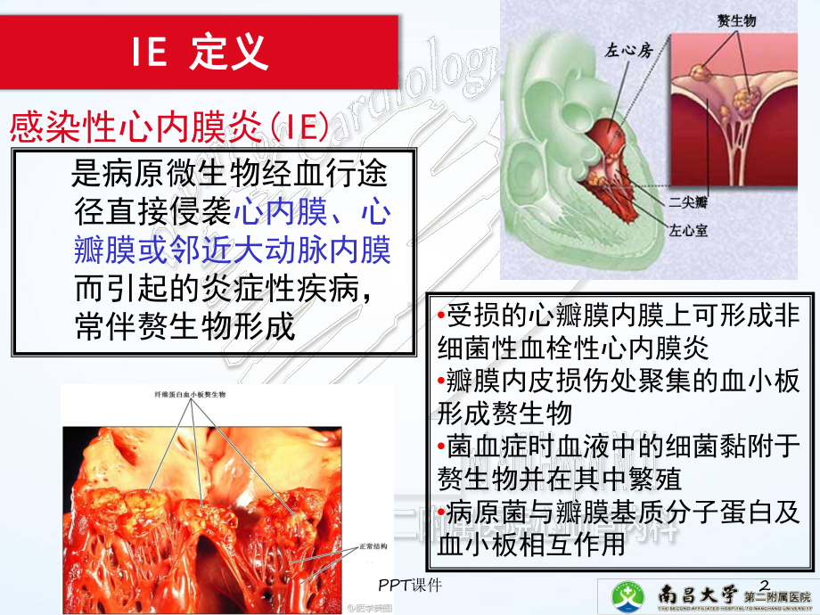 ESC-感染性心内膜炎指南-ppt课件.ppt_第2页