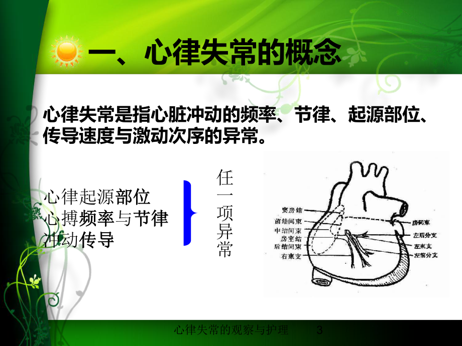 心律失常的观察与护理培训课件.ppt_第3页