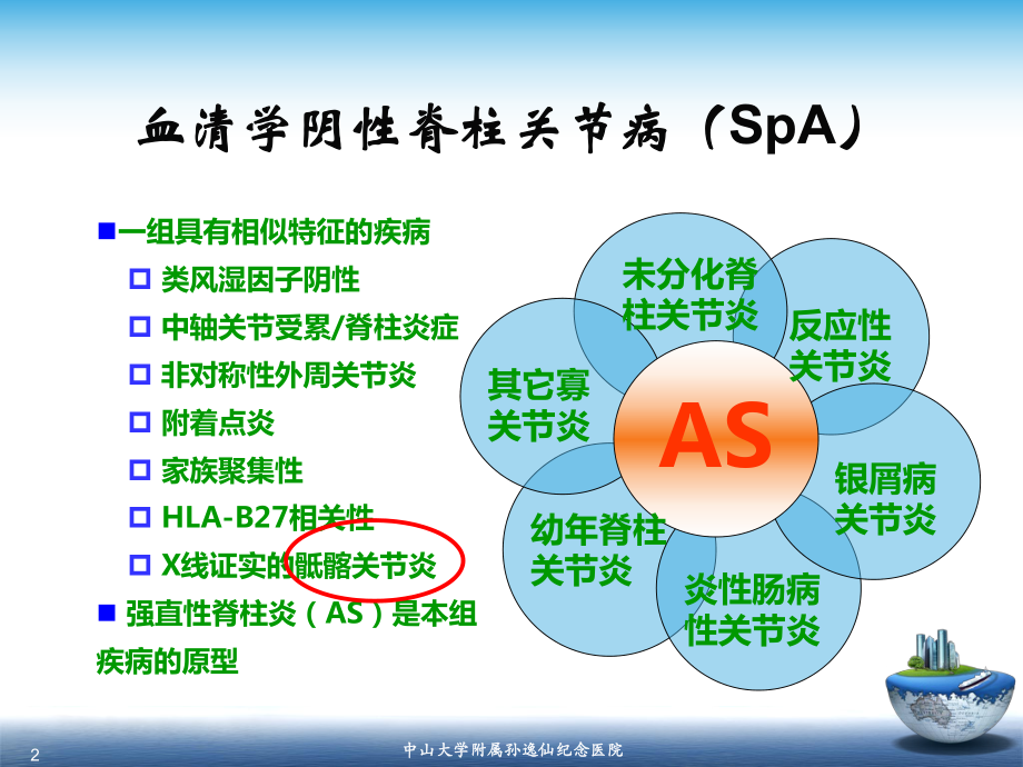 pA骶髂关节炎的影像学诊断与及鉴别诊断课件.ppt_第2页