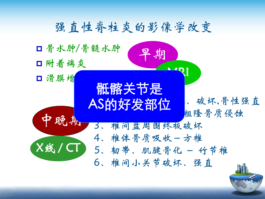 pA骶髂关节炎的影像学诊断与及鉴别诊断课件.ppt_第3页