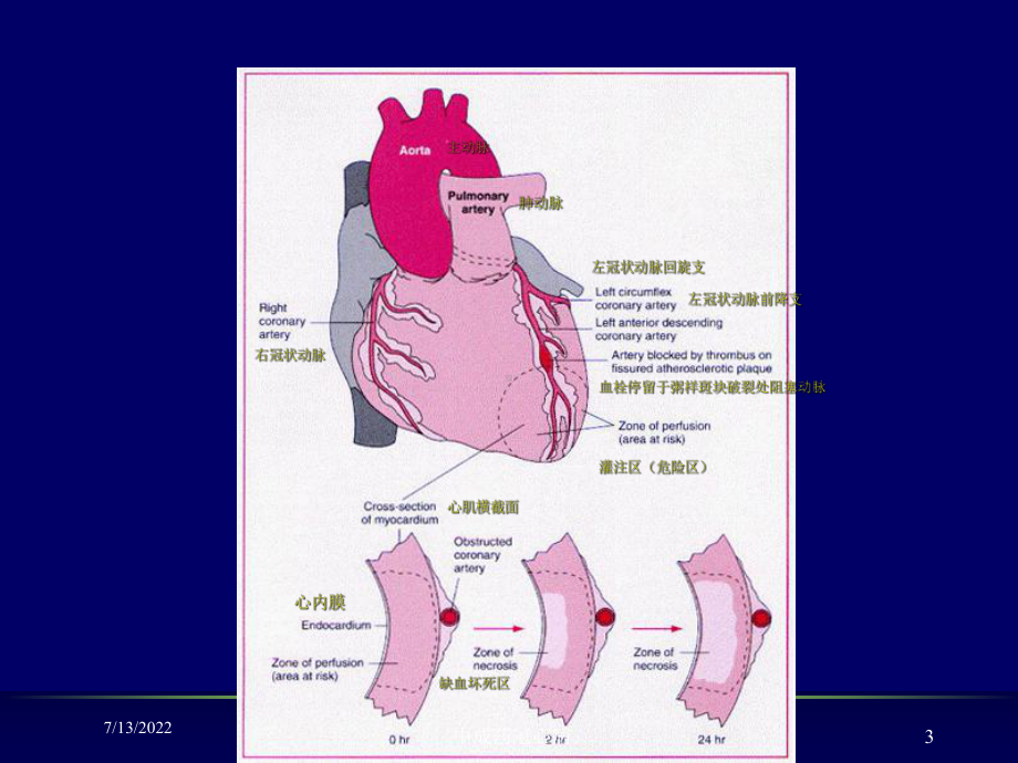 中成药冠心病培训课件.ppt_第3页