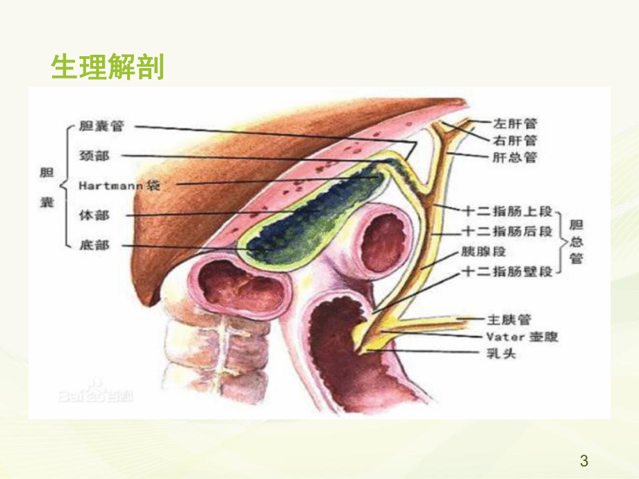 胆总管结石伴急性胆管炎ppt课件.pptx_第3页