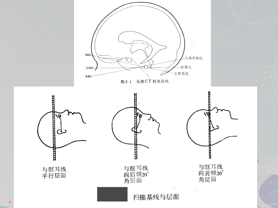 颅脑CT诊断-ppt课件.ppt_第3页