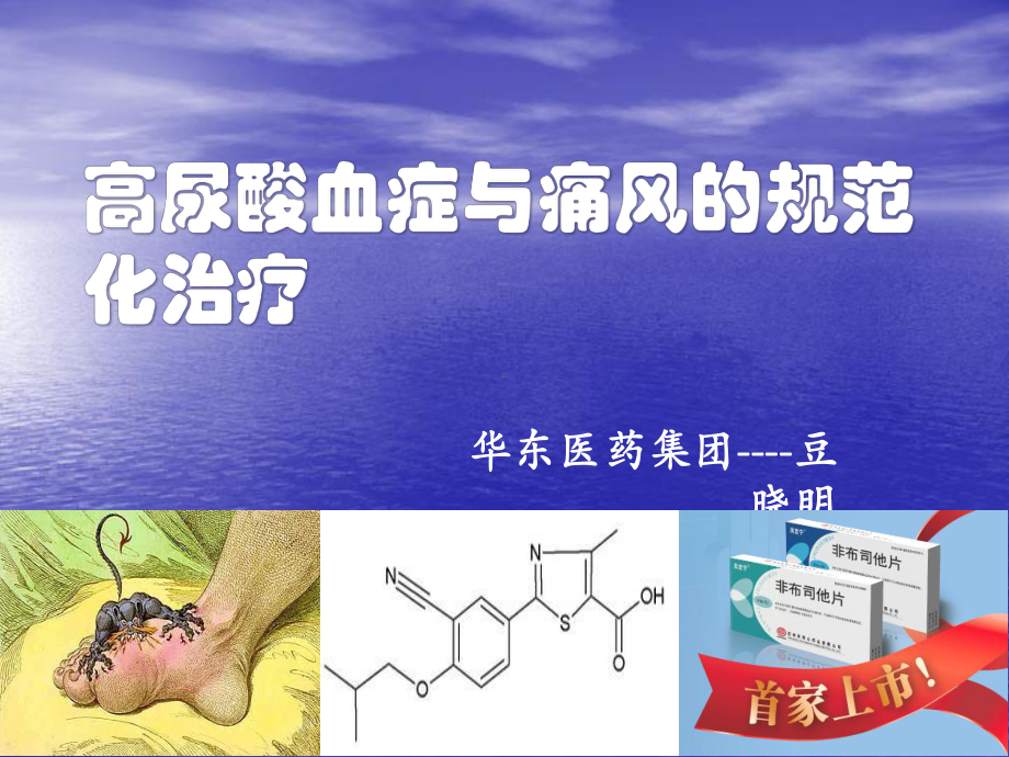 高尿酸与痛风的规范化治疗课件.ppt_第1页