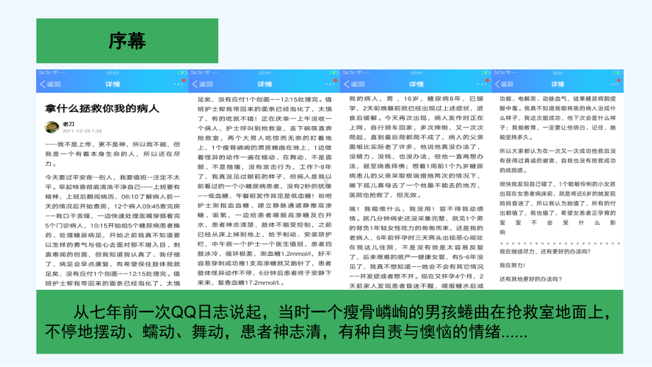 糖尿病性舞蹈症病例分享-PPT课件.ppt_第2页