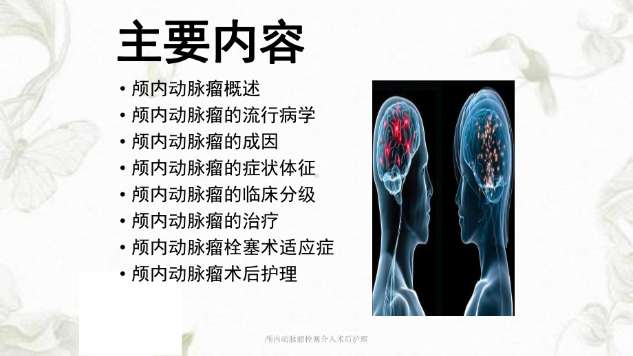 颅内动脉瘤栓塞介入术后护理ppt课件.ppt_第2页