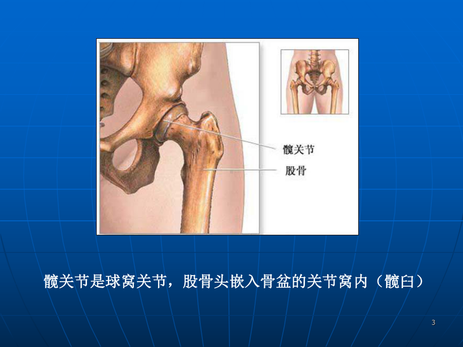 全髋关节置换术后康复PPT课件.ppt_第3页