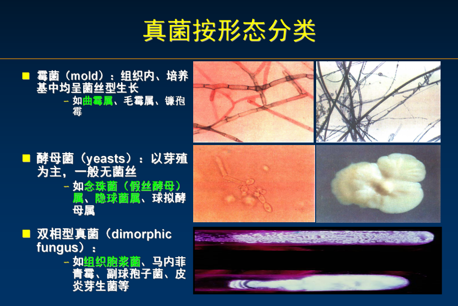 侵袭性肺曲霉病治疗-ppt课件.pptx_第2页