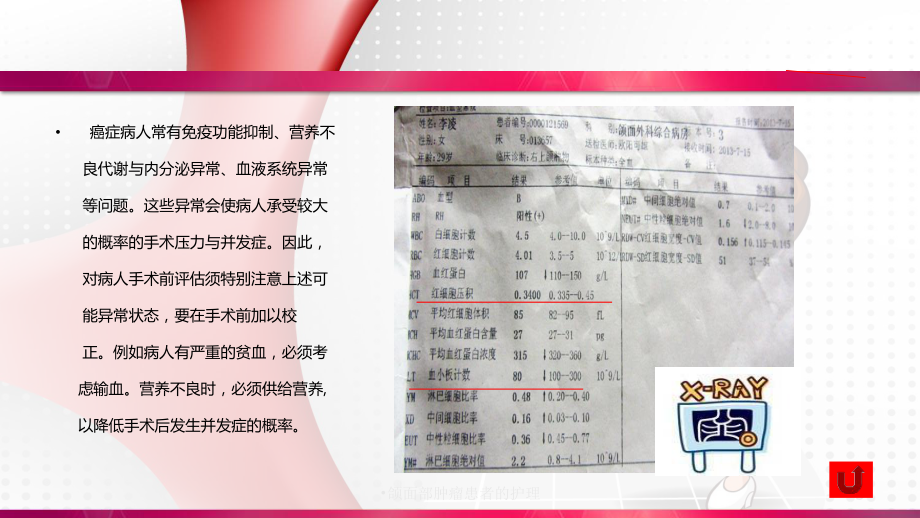 颌面部肿瘤患者的护理ppt课件.ppt_第3页