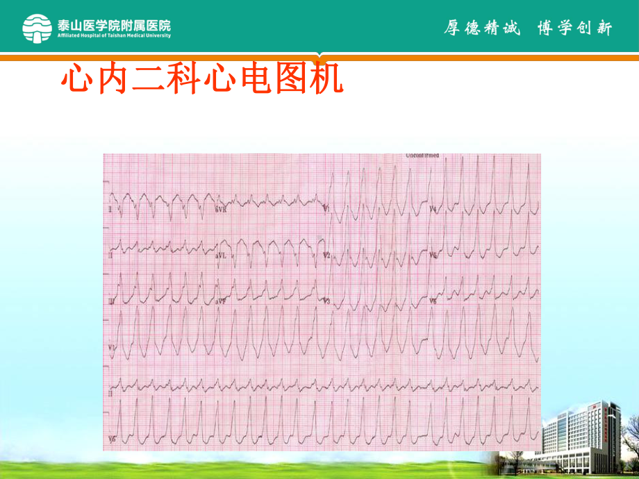 心内科常用检查与注意事项课件.ppt_第2页